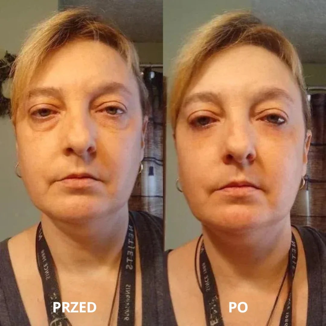 Alora | Peptid- und Kollagen-Hydrogel-Augenpads